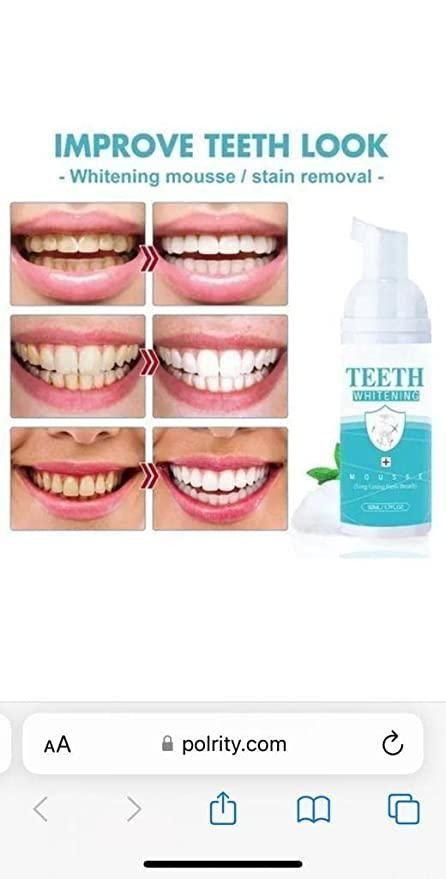 Teeth Whitening Foam for better teeth health